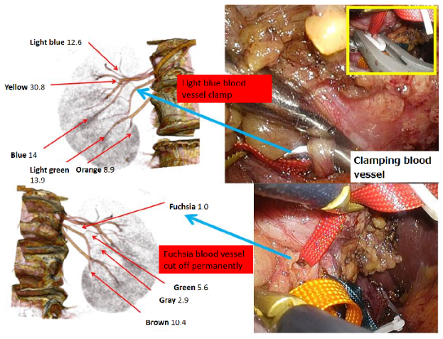 Figure 17