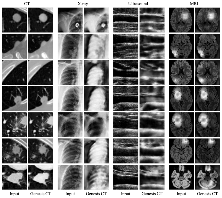Figure 11