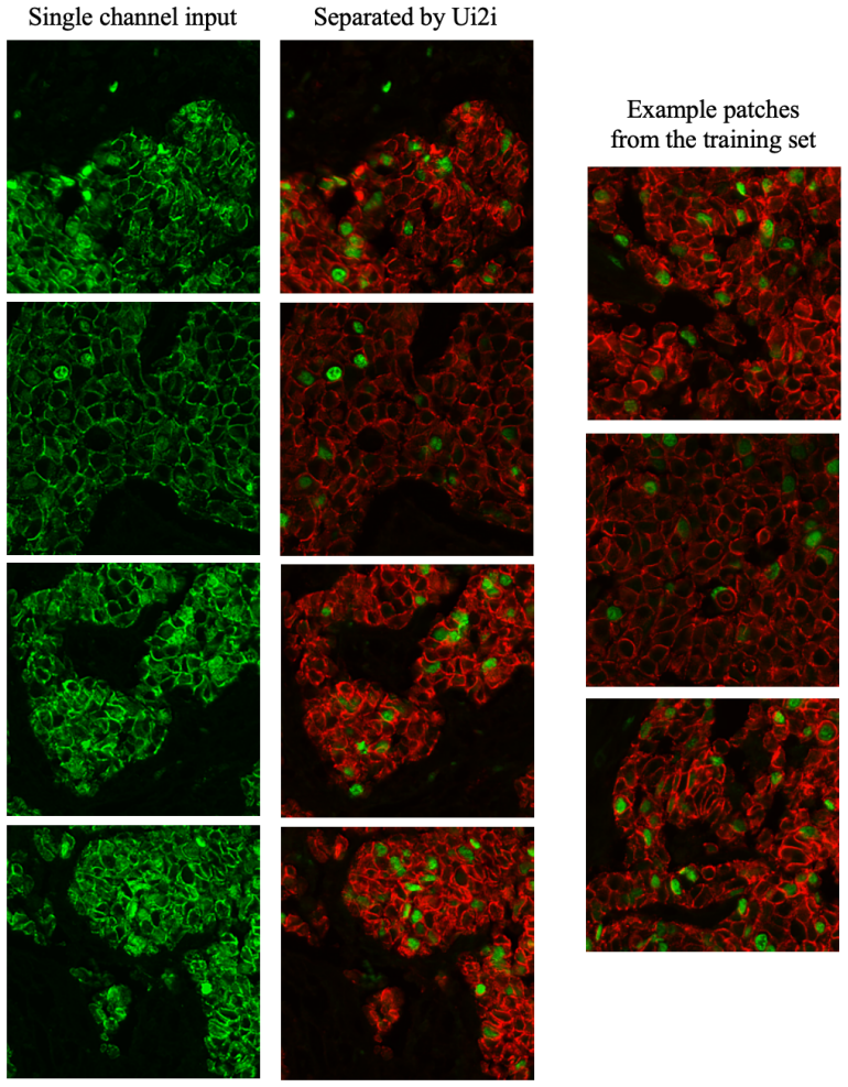 Figure 11