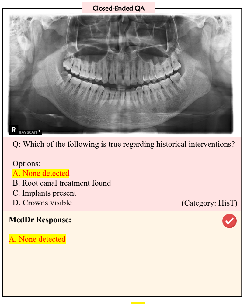 Figure 22