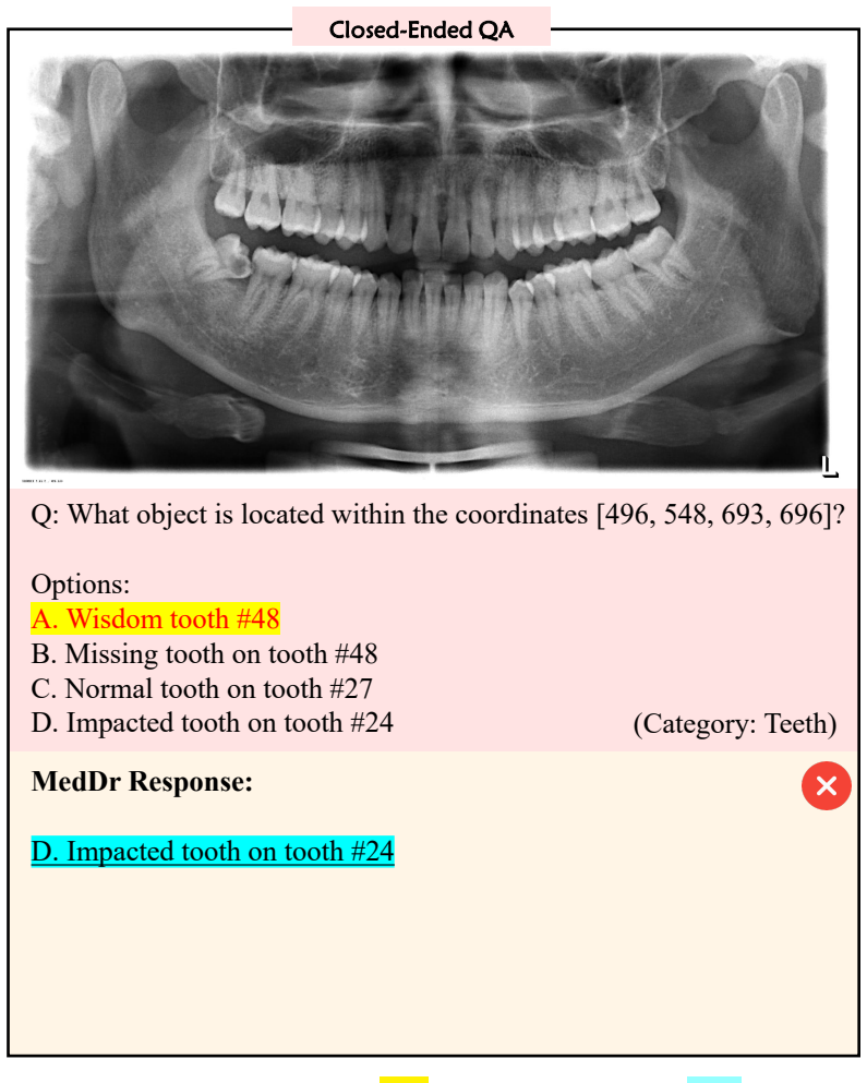 Figure 23