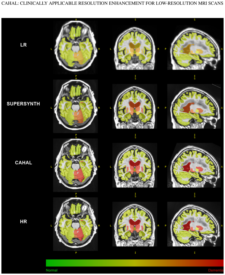 Figure 15
