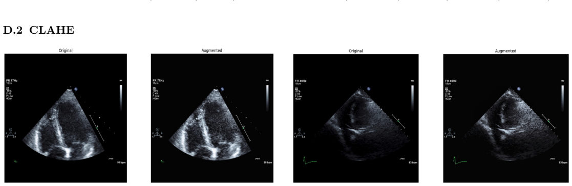 Figure 22