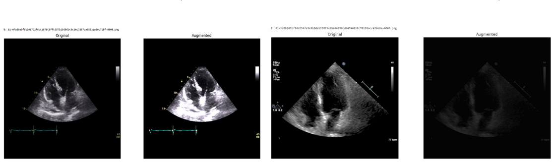 Figure 26