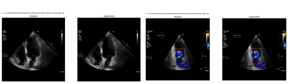 Figure 31