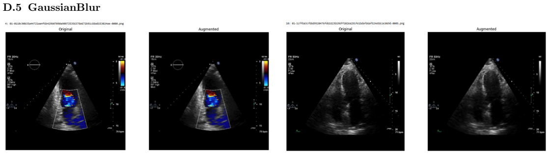 Figure 32