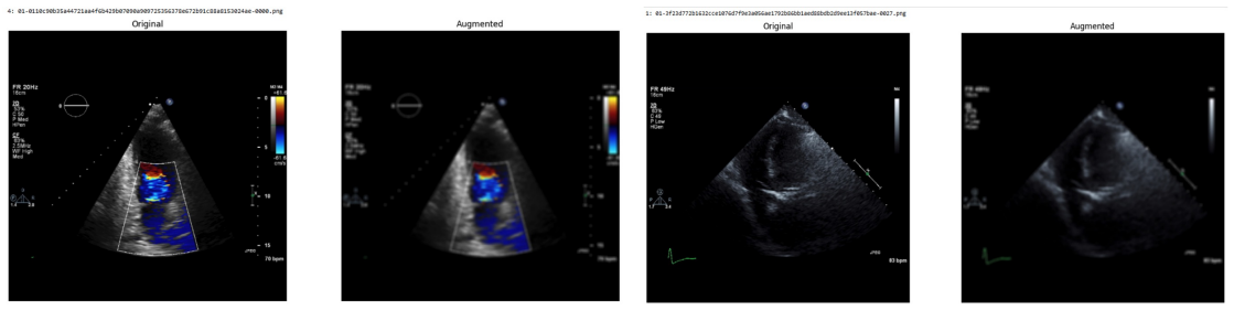 Figure 33