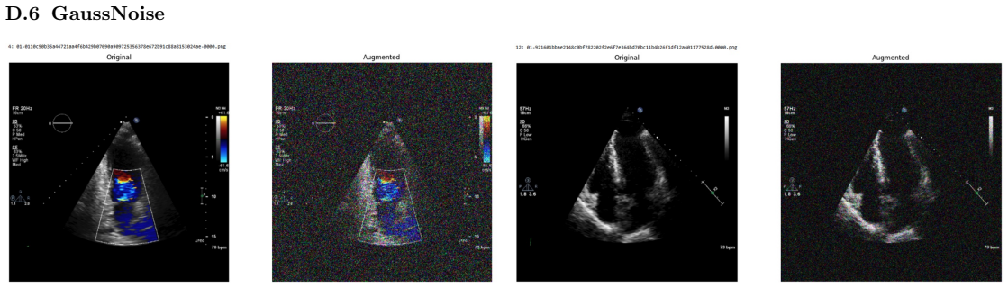 Figure 35