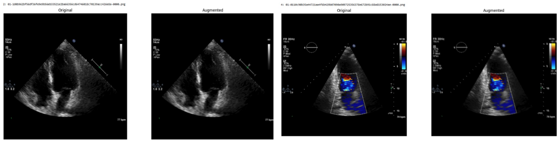 Figure 41