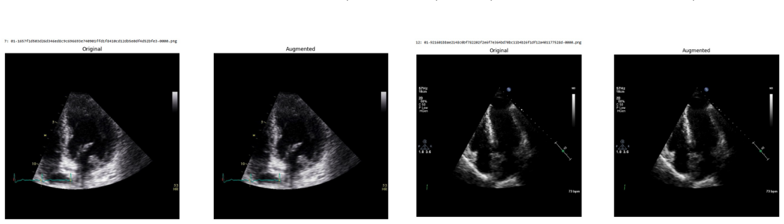 Figure 43