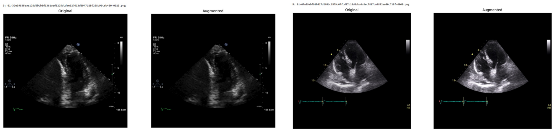 Figure 44