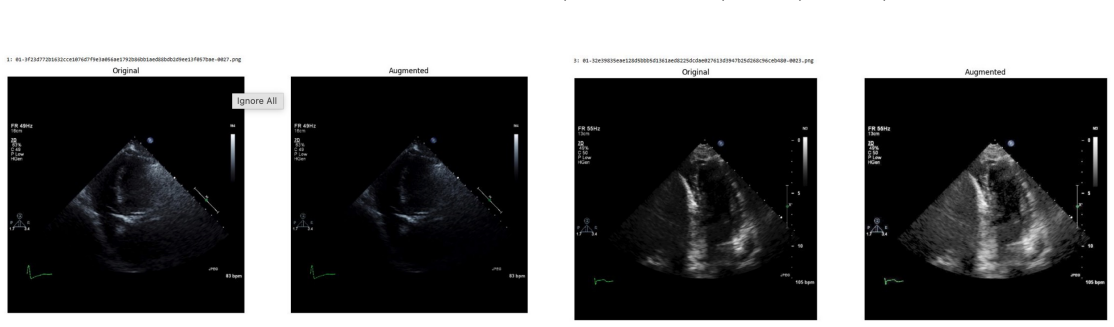 Figure 52