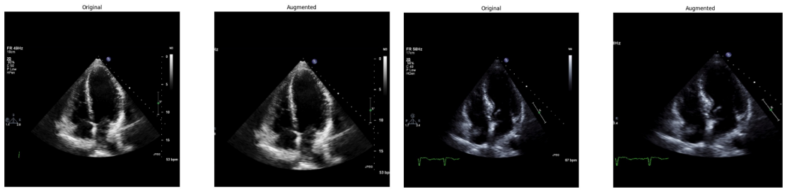 Figure 56