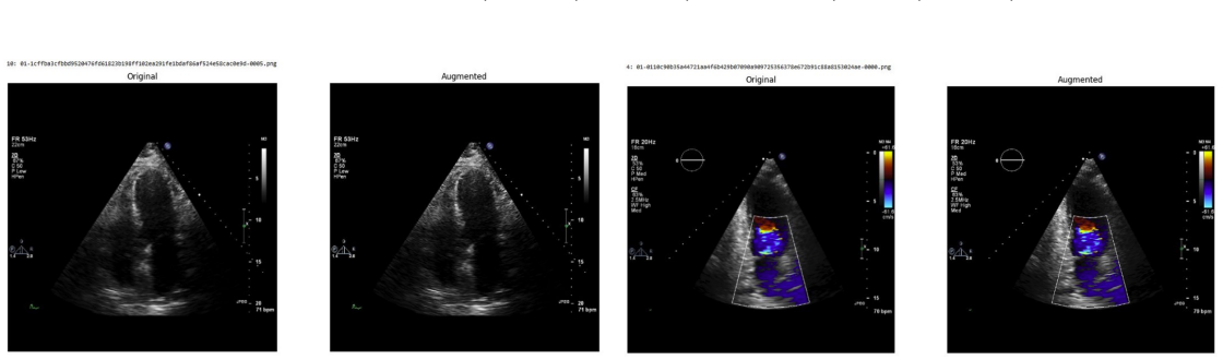 Figure 60