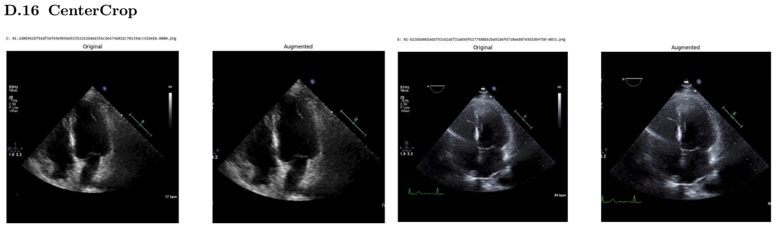 Figure 64