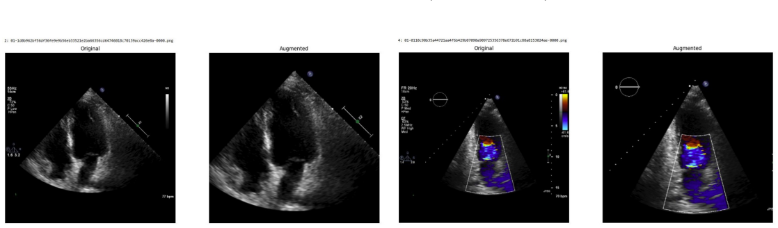 Figure 65
