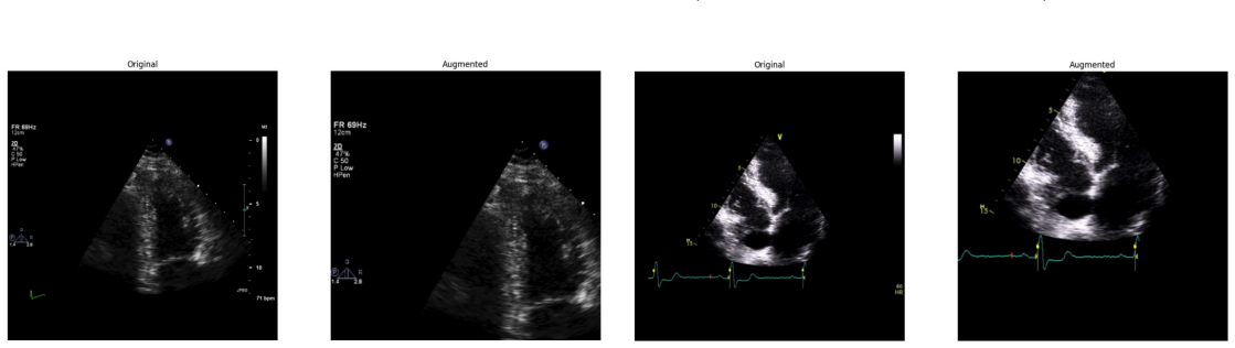 Figure 72