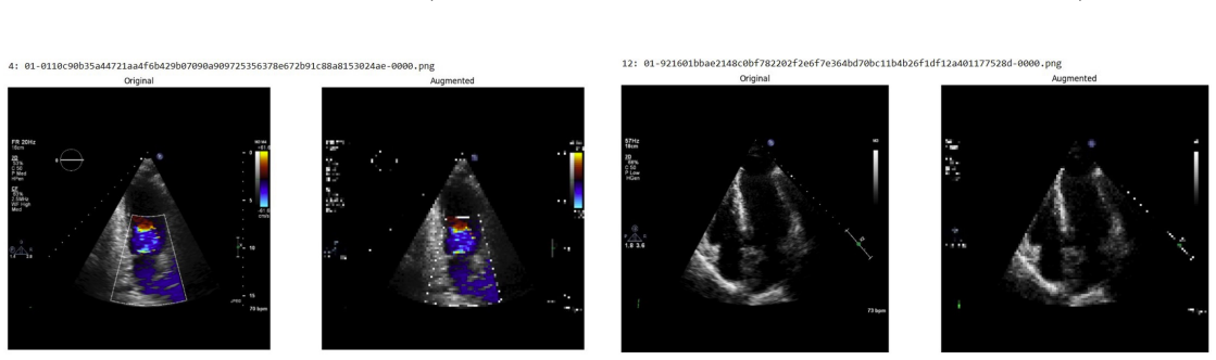 Figure 75