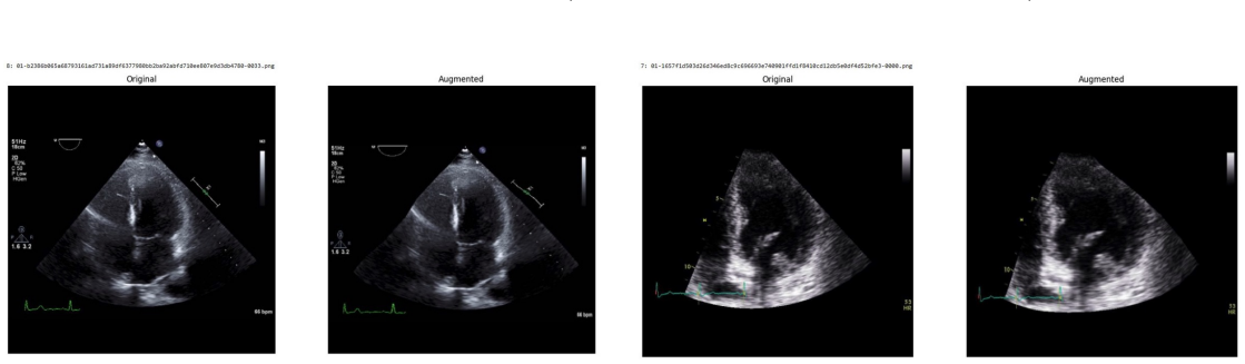 Figure 91