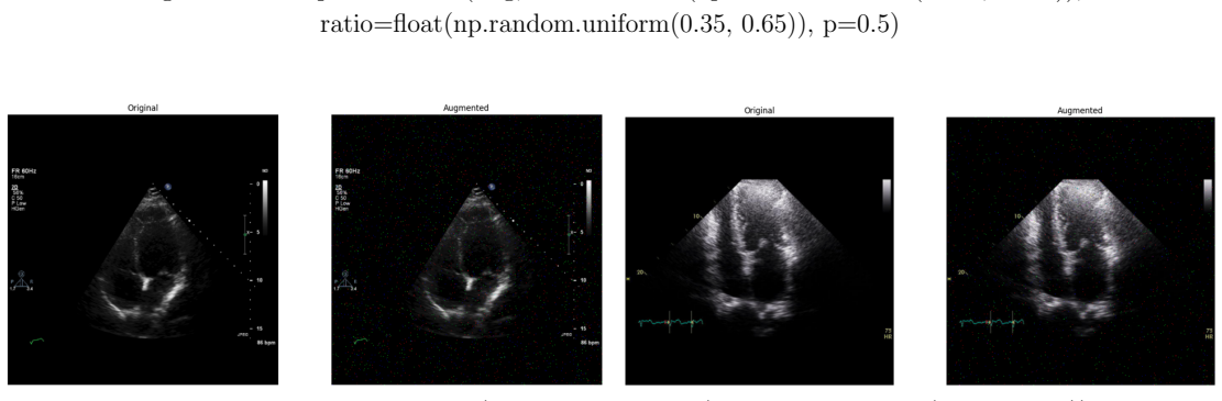 Figure 100