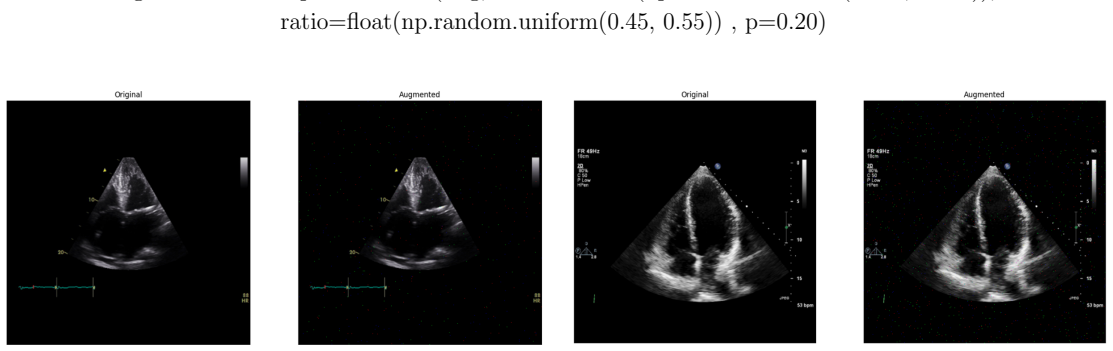 Figure 101