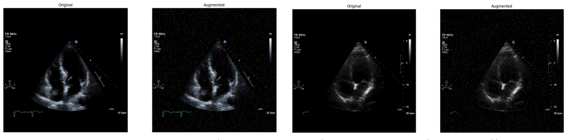 Figure 99
