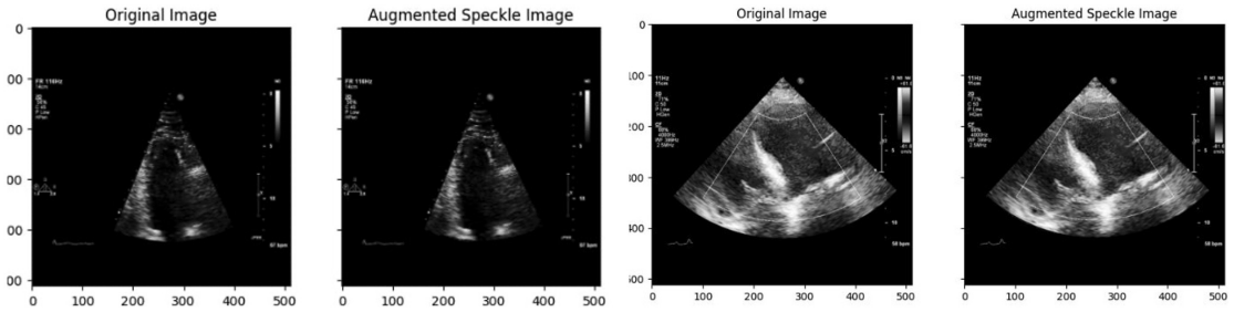 Figure 111