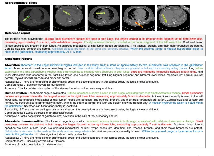 Figure 17