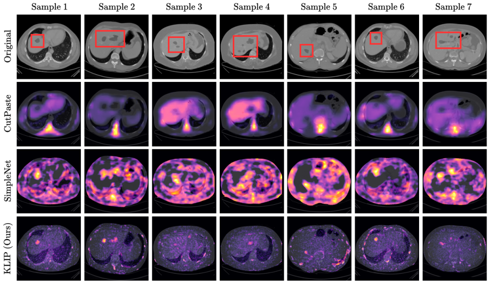 Figure 11