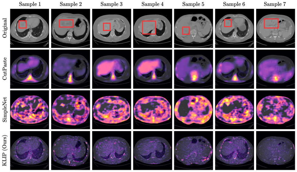 Figure 15