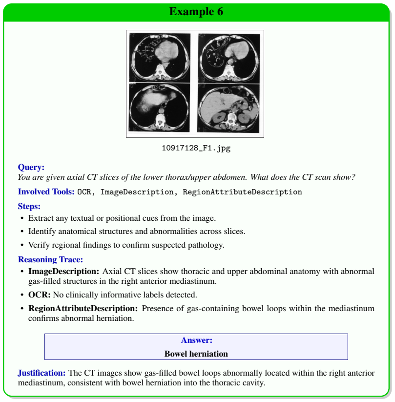Figure 22