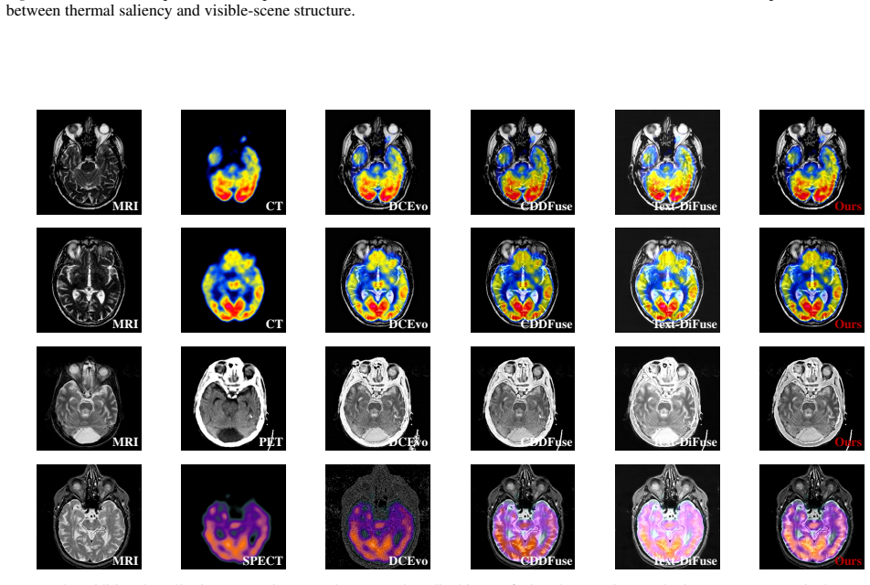 Figure 12