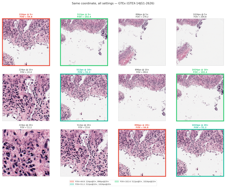 Figure 13