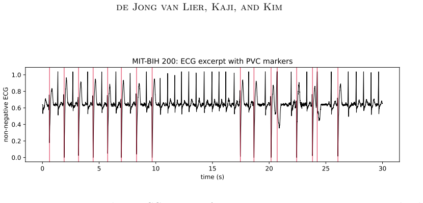 Figure 17
