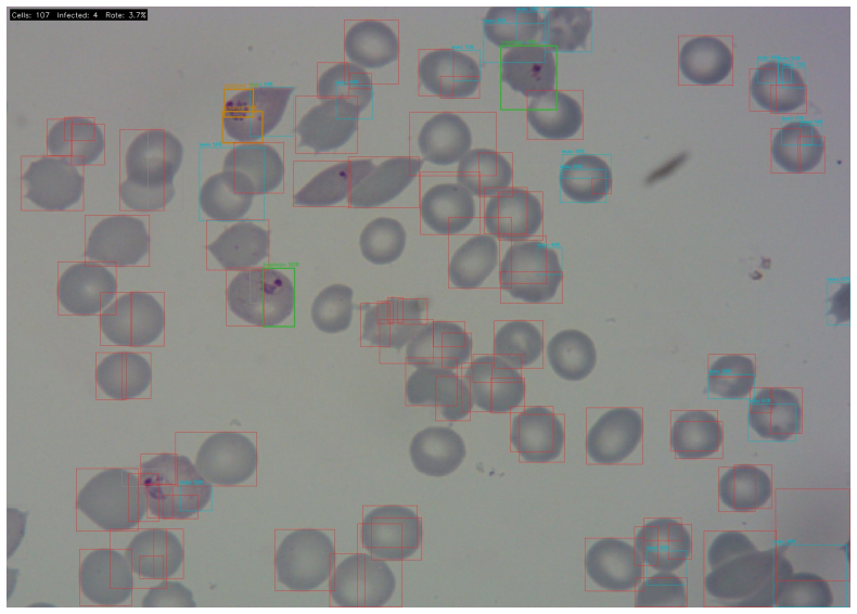 Figure 14